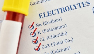 Wo kann man Elektrolyte kaufen? 
